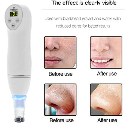 Skin Peeling Beauty Machine